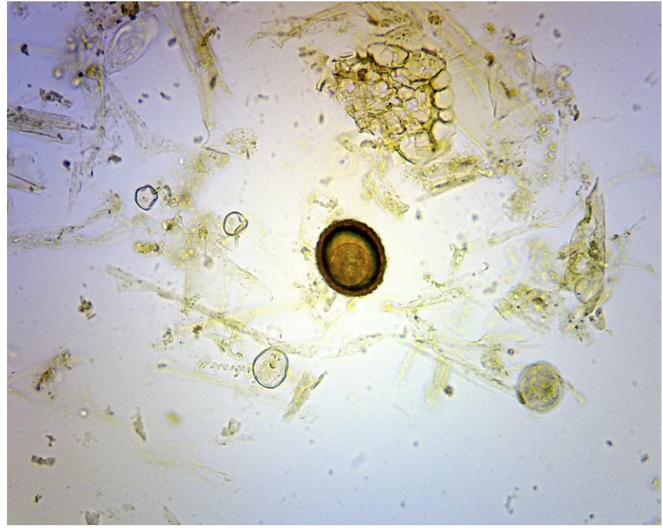 Ascarid Egg Ascarid Egg