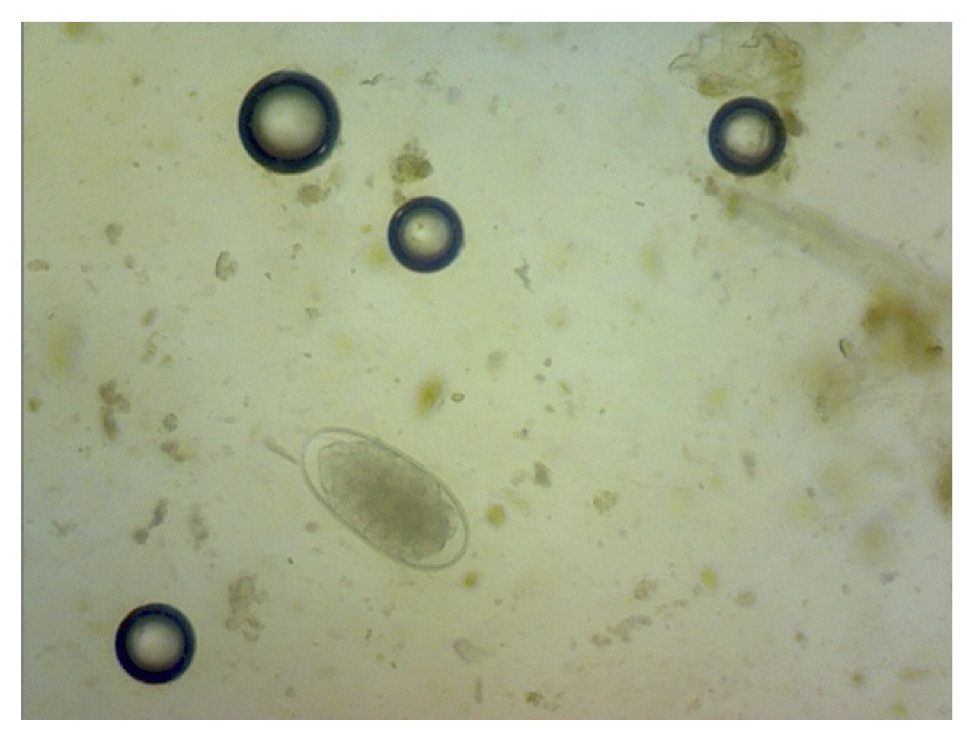 Strngyle Egg Air bubbles Strngyle Egg Air bubbles