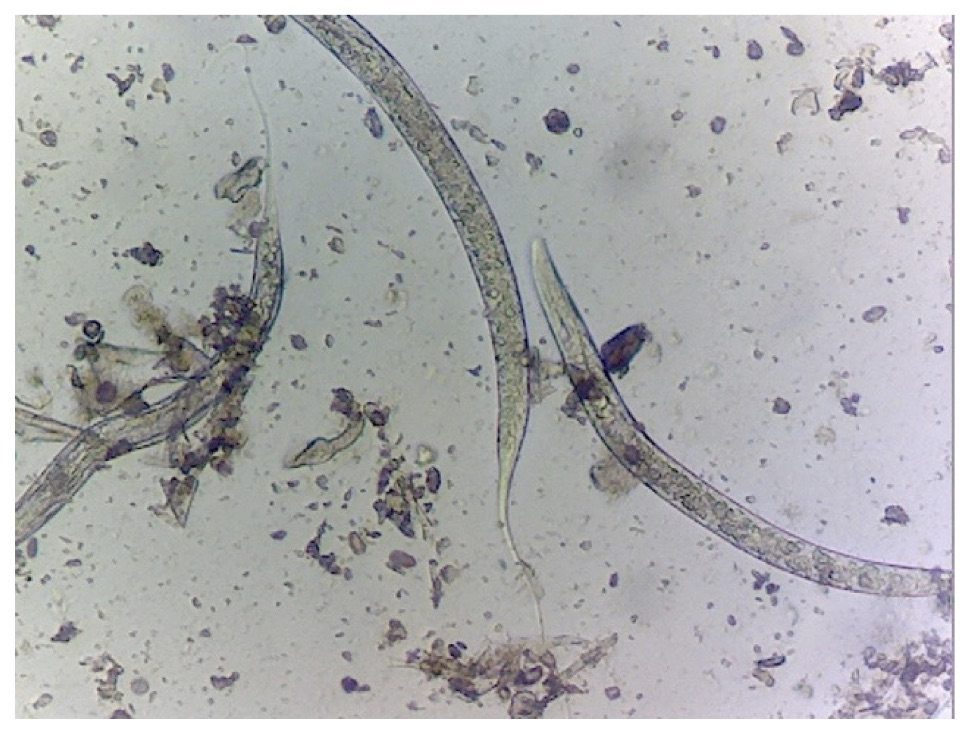 Stronglye Larvae Stage 1 Stronglye Larvae Stage 1