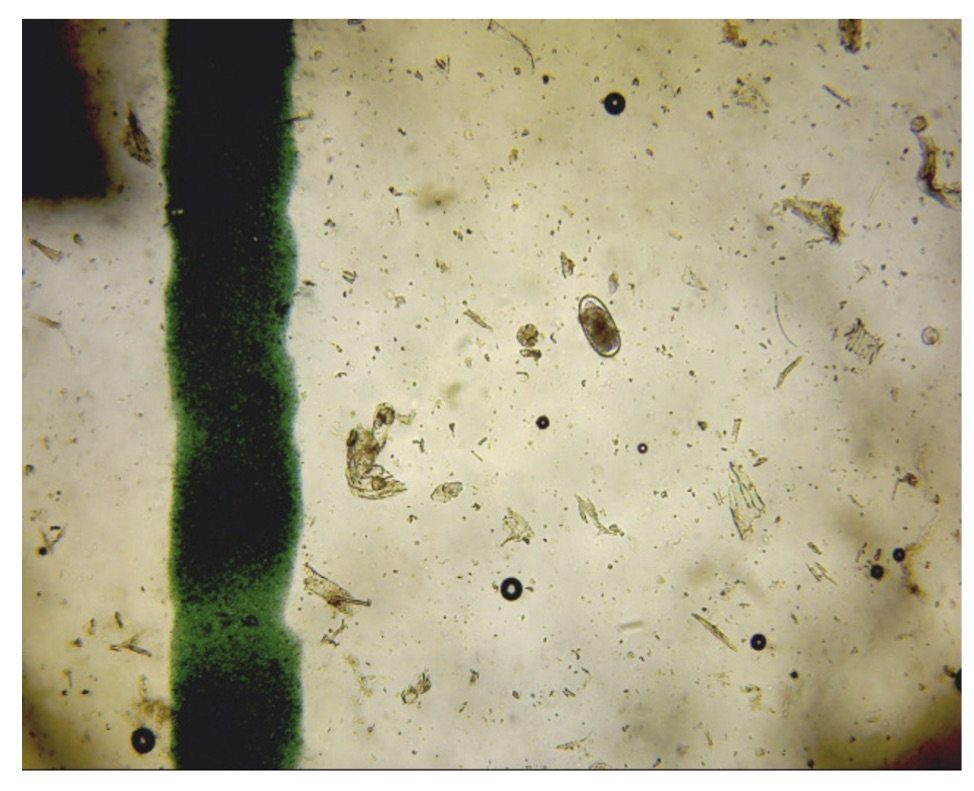 Strongyle Egg x 10 Lens Objective Strongyle Egg x 10 Lens Objective