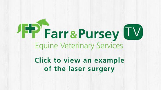 View laser surgery