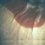 Normal-Greater-Curvature