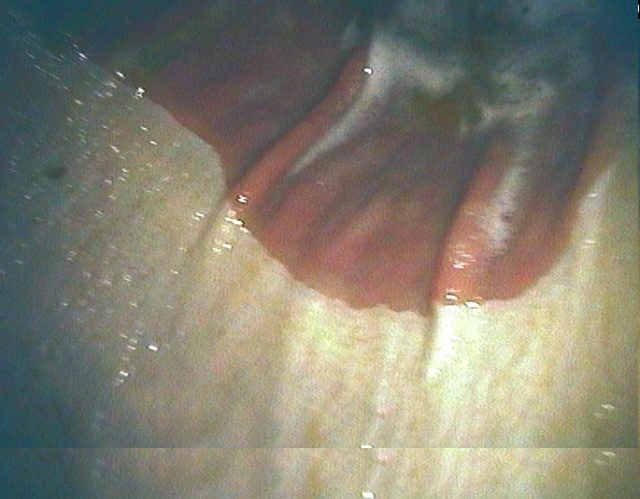 Normal-Greater-Curvature