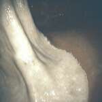 Normal-Lesser-Curvature