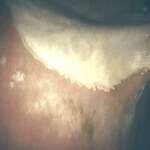 Normal-Lesser-Curvature-II